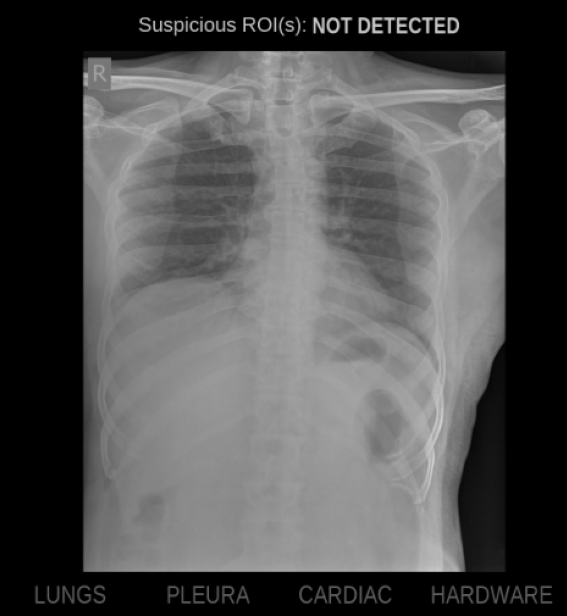 ECR 2024 poster